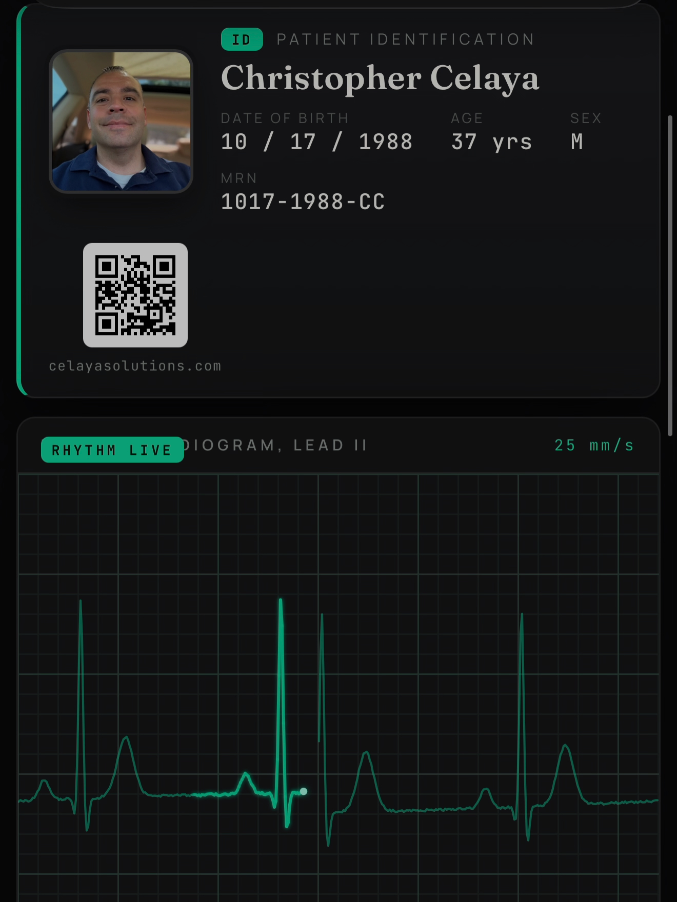 A patient identification card for Christopher Celaya beside a live electrocardiogram, Lead II, tracing a steady green rhythm across a dark grid.